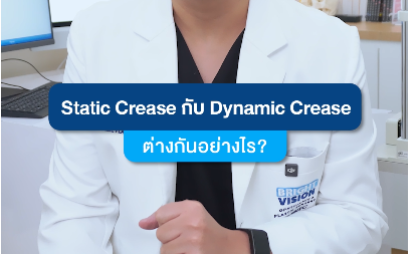 Static crease vs Dynamic crease ต่างกันอย่างไร?