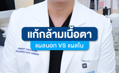 กล้ามเนื้อตาอ่อนแรง (Ptosis) แก้แบบไหนดี?